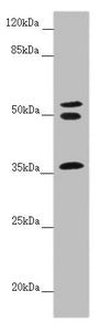 Western blot All lanes: RNF41 antibody at 5.55 ug/ml + Mouse brain tissue Secondary Goat polyclonal to rabbit IgG at 1/10000 dilution Predicted band size: 36, 28 kDa Observed band size: 36, 50, 55 kDa