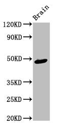 Western Blot
Positive WB detected in: Rat brain tissue
All lanes: AMBN antibody at 4ug/ml
Secondary
Goat polyclonal to rabbit IgG at 1/50000 dilution
Predicted band size: 49, 47 kDa
Observed band size: 49 kDa