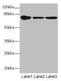 Western blot All lanes: FZD3 antibody at 1.94µg/ml Lane 1: THP-1 whole cell lysate Lane 2: Hela whole cell lysate Lane 3: HepG2 whole cell lysate Secondary Goat polyclonal to rabbit IgG at 1/10000 dilution Predicted band size: 77 kDa Observed band size: 77 kDa