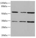 Western blot All lanes: IL17RB antibody at 2.16µg/ml Lane 1: 293T whole cell lysate Lane 2: Hela whole cell lysate Lane 3: HepG2 whole cell lysate Secondary Goat polyclonal to rabbit IgG at 1/10000 dilution Predicted band size: 56, 32 kDa Observed band size: 56, 32 kDa