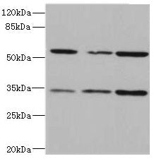 Western blot All lanes: IL17RB antibody at 2.16µg/ml Lane 1: 293T whole cell lysate Lane 2: Hela whole cell lysate Lane 3: HepG2 whole cell lysate Secondary Goat polyclonal to rabbit IgG at 1/10000 dilution Predicted band size: 56, 32 kDa Observed band size: 56, 32 kDa