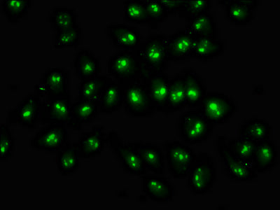 Immunofluorescence staining of Hela cells with CSB-PA882116LA01HU at 1:333, counter-stained with DAPI. The cells were fixed in 4% formaldehyde, permeabilized using 0.2% Triton X-100 and blocked in 10% normal Goat Serum. The cells were then incubated with the antibody overnight at 4&deg;C. The secondary antibody was Alexa Fluor 488-congugated AffiniPure Goat Anti-Rabbit IgG(H+L).
