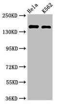 Western BlotPositive WB detected in: Hela whole cell lysate, K562 whole cell lysateAll lanes: CDK12 antibody at 2µg/mlSecondaryGoat polyclonal to rabbit IgG at 1/50000 dilutionPredicted band size: 165, 164, 142 kDaObserved band size: 165 kDa