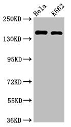 Western BlotPositive WB detected in: Hela whole cell lysate, K562 whole cell lysateAll lanes: CDK12 antibody at 2µg/mlSecondaryGoat polyclonal to rabbit IgG at 1/50000 dilutionPredicted band size: 165, 164, 142 kDaObserved band size: 165 kDa