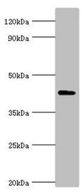 Western blot
All lanes: Aryl-hydrocarbon-interacting protein-like 1 antibody at 5ug/ml + Rat brain tissue
Secondary
Goat polyclonal to rabbit IgG at 1/10000 dilution
Predicted band size: 44, 37, 42, 41 kDa
Observed band size: 44 kDa