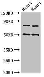 Western Blot
Positive WB detected in: Rat heart tissue, Mouse heart tissue
All lanes: Acss2 antibody at 4ug/ml
Secondary
Goat polyclonal to rabbit IgG at 1/50000 dilution
Predicted band size: 79 kDa
Observed band size: 79, 50 kDa