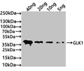 Western Blot
Positive WB detected in: recombinant protein
All lanes: GLK1 Antibody at 1:1000
Secondary
Goat polyclonal to rabbit IgG at 1/50000 dilution
Predicted band size: 37 kDa
Observed band size: 37 kDa