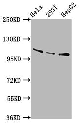 Western Blot
Positive WB detected in: Hela whole cell lysate, 293T whole cell lysate, HepG2 whole cell lysate
All lanes: AASS antibody at 5.8µg/ml
Secondary
Goat polyclonal to rabbit IgG at 1/50000 dilution
Predicted band size: 103 kDa
Observed band size: 103 kDa