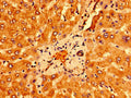 Immunohistochemistry of paraffin-embedded human liver tissue using CSB-PA883431LA01HU at dilution of 1:100
