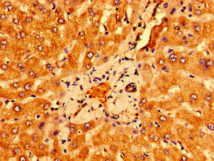 Immunohistochemistry of paraffin-embedded human liver tissue using CSB-PA883431LA01HU at dilution of 1:100