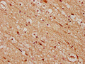 IHC image of CSB-PA883643LA01HU diluted at 1:200 and staining in paraffin-embedded human brain tissue performed on a Leica BondTM system. After dewaxing and hydration, antigen retrieval was mediated by high pressure in a citrate buffer (pH 6.0). Section was blocked with 10% normal goat serum 30min at RT. Then primary antibody (1% BSA) was incubated at 4°C overnight. The primary is detected by a biotinylated secondary antibody and visualized using an HRP conjugated SP system.