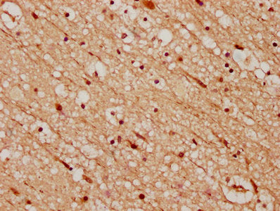 IHC image of CSB-PA883643LA01HU diluted at 1:200 and staining in paraffin-embedded human brain tissue performed on a Leica BondTM system. After dewaxing and hydration, antigen retrieval was mediated by high pressure in a citrate buffer (pH 6.0). Section was blocked with 10% normal goat serum 30min at RT. Then primary antibody (1% BSA) was incubated at 4°C overnight. The primary is detected by a biotinylated secondary antibody and visualized using an HRP conjugated SP system.