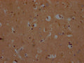 IHC image of CSB-PA884445PA01HU diluted at 1:200 and staining in paraffin-embedded human brain tissue performed on a Leica BondTM system. After dewaxing and hydration, antigen retrieval was mediated by high pressure in a citrate buffer (pH 6.0). Section was blocked with 10% normal goat serum 30min at RT. Then primary antibody (1% BSA) was incubated at 4°C overnight. The primary is detected by a Goat anti-rabbit polymer IgG labeled by HRP and visualized using 0.05% DAB.