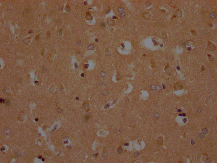 IHC image of CSB-PA884445PA01HU diluted at 1:200 and staining in paraffin-embedded human brain tissue performed on a Leica BondTM system. After dewaxing and hydration, antigen retrieval was mediated by high pressure in a citrate buffer (pH 6.0). Section was blocked with 10% normal goat serum 30min at RT. Then primary antibody (1% BSA) was incubated at 4°C overnight. The primary is detected by a Goat anti-rabbit polymer IgG labeled by HRP and visualized using 0.05% DAB.