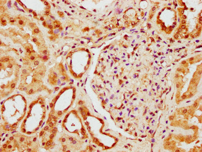 IHC image of CSB-PA884488LA01HU diluted at 1:300 and staining in paraffin-embedded human kidney tissue performed on a Leica BondTM system. After dewaxing and hydration, antigen retrieval was mediated by high pressure in a citrate buffer&nbsp;(pH 6.0). Section was blocked with 10% normal goat serum 30min at RT. Then primary antibody&nbsp;(1% BSA) was incubated at 4&deg;C overnight. The primary is detected by a biotinylated secondary antibody and visualized using an HRP conjugated SP system.