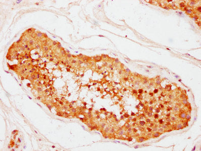 IHC image of CSB-PA884495LA01HU diluted at 1:400 and staining in paraffin-embedded human testis tissue performed on a Leica BondTM system. After dewaxing and hydration, antigen retrieval was mediated by high pressure in a citrate buffer (pH 6.0). Section was blocked with 10% normal goat serum 30min at RT. Then primary antibody (1% BSA) was incubated at 4°C overnight. The primary is detected by a biotinylated secondary antibody and visualized using an HRP conjugated SP system.