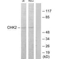 Western blot analysis of extracts from Jurkat and HeLa cells treated with etoposide 25uM 24hours, using Chk2 (Ab-68) antibody.