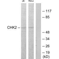 Western blot analysis of extracts from Jurkat and HeLa cells treated with etoposide 25uM 24hours, using Chk2 (Ab-68) antibody.