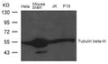 Western blot analysis of extract from Mouse brain tissue, Hela, JK and P19 cells using Tubulin beta-III  Antibody