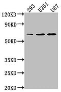 Western Blot
Positive WB detected in: 293 whole cell lysate, U251 whole cell lysate, U87 whole cell lysate
All lanes: TCF7L1 antibody at 1:1000
Secondary
Goat polyclonal to rabbit IgG at 1/50000 dilution
Predicted band size: 63 kDa
Observed band size: 63 kDa