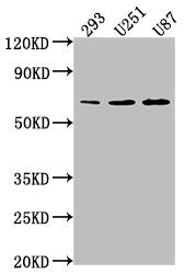 Western Blot
Positive WB detected in: 293 whole cell lysate, U251 whole cell lysate, U87 whole cell lysate
All lanes: TCF7L1 antibody at 1:1000
Secondary
Goat polyclonal to rabbit IgG at 1/50000 dilution
Predicted band size: 63 kDa
Observed band size: 63 kDa