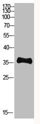 Western Blot analysis of KB cells using Antibody diluted at 500. Secondary antibody  was diluted at 1:20000