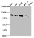 Western Blot
Positive WB detected in: Hela whole cell lysate, U87 whole cell lysate, U251 whole cell lysate, MCF-7 whole cell lysate, Rat heart tissue
All lanes: ANO2 antibody at 3.9µg/ml
Secondary
Goat polyclonal to rabbit IgG at 1/50000 dilution
Predicted band size: 114 kDa
Observed band size: 114 kDa