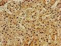 Immunohistochemistry of paraffin-embedded human adrenal gland tissue using CSB-PA885715LA01HU at dilution of 1:100