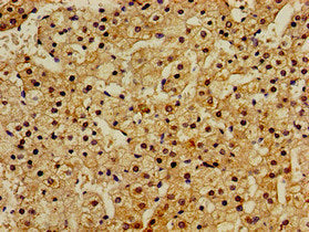 Immunohistochemistry of paraffin-embedded human adrenal gland tissue using CSB-PA885715LA01HU at dilution of 1:100