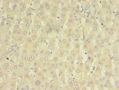 Immunohistochemistry of paraffin-embedded human liver tissue using CSB-PA885720LA01HU at dilution of 1:100