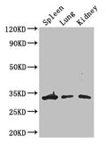 Western Blot
Positive WB detected in: Mouse spleen tissue, Mouse lung tissue, Mouse kidney tissue
All lanes: ALKBH4 antibody at 3ug/ml
Secondary
Goat polyclonal to rabbit IgG at 1/50000 dilution
Predicted band size: 34, 5 kDa
Observed band size: 34 kDa