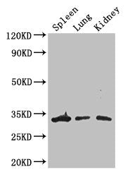 Western Blot
Positive WB detected in: Mouse spleen tissue, Mouse lung tissue, Mouse kidney tissue
All lanes: ALKBH4 antibody at 3ug/ml
Secondary
Goat polyclonal to rabbit IgG at 1/50000 dilution
Predicted band size: 34, 5 kDa
Observed band size: 34 kDa