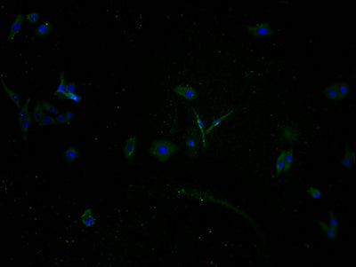 Immunofluorescence staining of HepG2 cells with CSB-PA885769PA01HU at 1:100, counter-stained with DAPI. The cells were fixed in 4% formaldehyde and blocked in 10% normal Goat Serum. The cells were then incubated with the antibody overnight at 4°C. The secondary antibody was Alexa Fluor 488-congugated AffiniPure Goat Anti-Rabbit IgG(H+L).