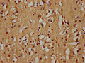 IHC image of CSB-PA885781LA01HU diluted at 1:300 and staining in paraffin-embedded human brain tissue performed on a Leica BondTM system. After dewaxing and hydration, antigen retrieval was mediated by high pressure in a citrate buffer (pH 6.0). Section was blocked with 10% normal goat serum 30min at RT. Then primary antibody (1% BSA) was incubated at 4°C overnight. The primary is detected by a biotinylated secondary antibody and visualized using an HRP conjugated SP system.
