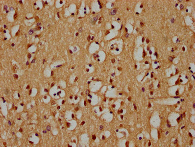 IHC image of CSB-PA885781LA01HU diluted at 1:300 and staining in paraffin-embedded human brain tissue performed on a Leica BondTM system. After dewaxing and hydration, antigen retrieval was mediated by high pressure in a citrate buffer (pH 6.0). Section was blocked with 10% normal goat serum 30min at RT. Then primary antibody (1% BSA) was incubated at 4°C overnight. The primary is detected by a biotinylated secondary antibody and visualized using an HRP conjugated SP system.
