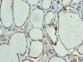 Immunohistochemistry of paraffin-embedded human thyroid tissue using CSB-PA885806LA01HU at dilution of 1:100