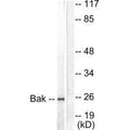 Western blot analysis of extracts from 293 cells, using Bak antibody.