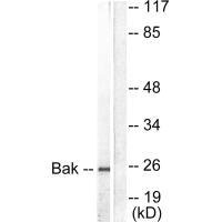 Western blot analysis of extracts from 293 cells, using Bak antibody.