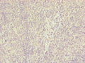 IL36A Antibody – Figure 1 of 1
