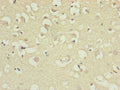 Immunohistochemistry of paraffin-embedded human brain tissue using CSB-PA887028ESR2HU at dilution of 1:100