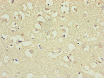 Immunohistochemistry of paraffin-embedded human brain tissue using CSB-PA887028ESR2HU at dilution of 1:100