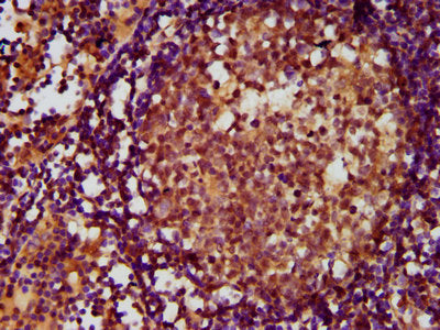 IHC image of CSB-PA887050LA01HU diluted at 1:500 and staining in paraffin-embedded human lymph node tissue performed on a Leica BondTM system. After dewaxing and hydration, antigen retrieval was mediated by high pressure in a citrate buffer (pH 6.0). Section was blocked with 10% normal goat serum 30min at RT. Then primary antibody (1% BSA) was incubated at 4&deg;C overnight. The primary is detected by a biotinylated secondary antibody and visualized using an HRP conjugated SP system.