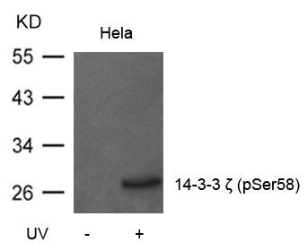 Western blot analysis of extracts from Hela cells untreated or treated with UV using 14-3-3z(Phospho-Ser58) Antibody.