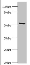Western blot All lanes: ALG1 antibody at 10ug/ml + Hela whole cell lysate Secondary Goat polyclonal to rabbit IgG at 1/10000 dilution Predicted band size: 53, 41 kDa Observed band size: 53 kDa