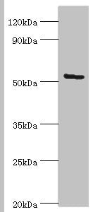 Western blot All lanes: ALG1 antibody at 10ug/ml + Hela whole cell lysate Secondary Goat polyclonal to rabbit IgG at 1/10000 dilution Predicted band size: 53, 41 kDa Observed band size: 53 kDa