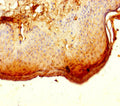 Immunohistochemistry of paraffin-embedded human skin tissue using CSB-PA887130LA01HU at dilution of 1:100
