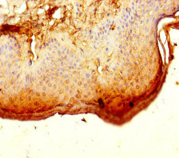 Immunohistochemistry of paraffin-embedded human skin tissue using CSB-PA887130LA01HU at dilution of 1:100