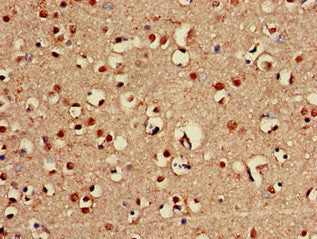 Immunohistochemistry of paraffin-embedded human brain tissue using CSB-PA887172LA01HU at dilution of 1:100