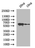 Western Blot
Positive WB detected in: recombinant protein
All lanes: At5g42100 Antibody at 1:1000
Secondary
Goat polyclonal to rabbit IgG at 1/50000 dilution
Predicted band size: 66 kDa
Observed band size: 66 kDa