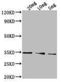 Western Blot
Positive WB detected in Recombinant protein
All lanes: PDAT1 antibody at 1:2000
Secondary
Goat polyclonal to rabbit IgG at 1/50000 dilution
Predicted band size: 26.5 kDa
Observed band size: 35 kDa